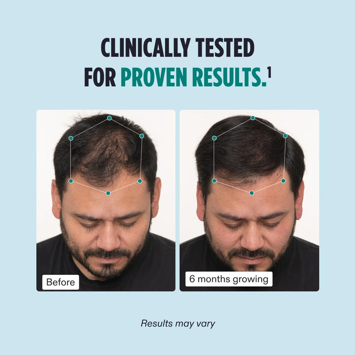 Nutrafol Men's Hair Growth Supplements Clinically Tested for Visibly Thicker Hair and Scalp Coverage